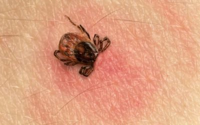 Is LYME DISEASE Making Me Sick?