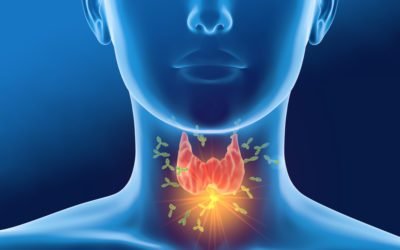 How to Fix High Thyroid Antibodies