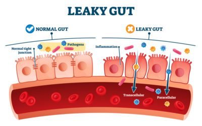 How To Heal A Leaky Gut Without Pharmaceutical Drugs