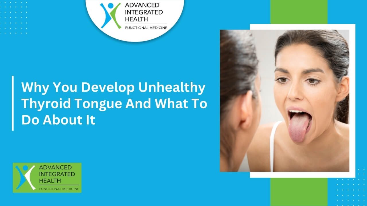 unhealthy thyroid tongue